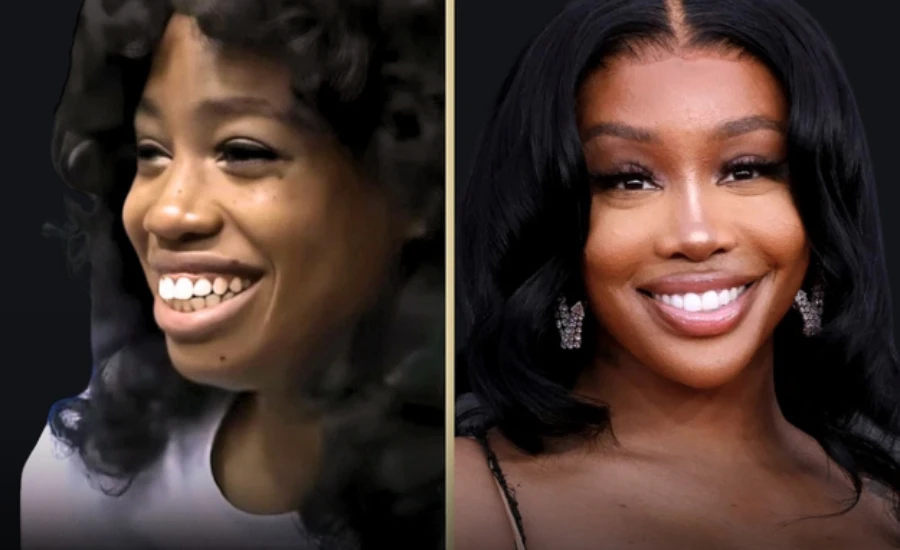 SZA Before Surgery