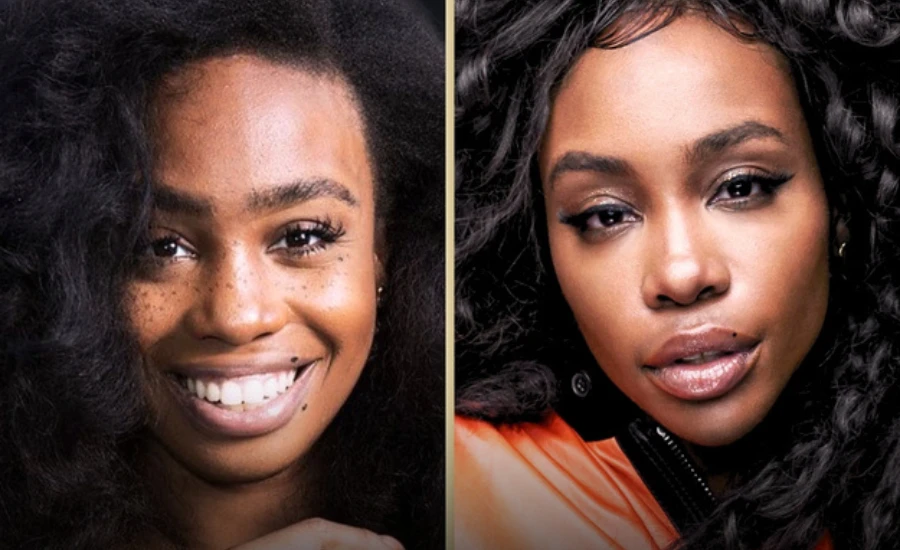 SZA Before Surgery