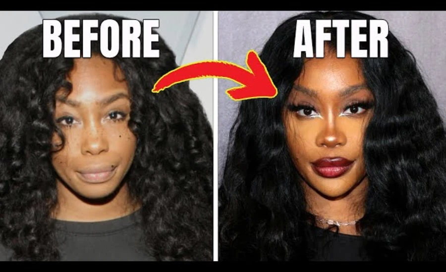 SZA Before Surgery