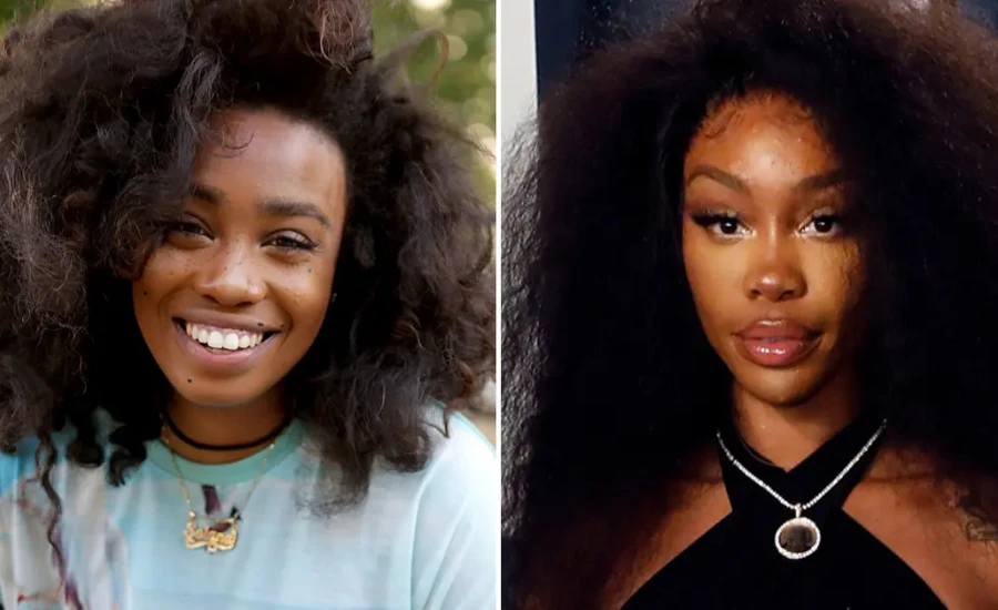 SZA Before Surgery